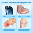 thumbnail image 2 of 2Pcs Fractured Big Toe Splint Brace, suitable for protecting dislocated, injured, or sprained big toe fractures, includes 1 stainless steel plate support.【Left】, 2 of 7