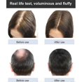 thumbnail image 5 of Ginger Plant Extract Anti-hair Loss Hair Shampoo, 2024 New Ginger Plant Extract Anti-hair Loss Hair Shampoo, Ginger Shampoo For Hair Growth, 5 of 5
