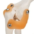 thumbnail image 2 of Elbow Joint Model Life Size Accurate Elbow Skeleton Model Resin + Pvc 7.5 X 4.7 X 4.7In Contains Part Of Humerus Placed On The Base Frame Detachable For Study Display Teaching, 2 of 8