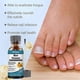 thumbnail image 4 of Powerful Nail Repair Serum with Natural Ingredients - Rapid Relief for Toenail Issues and Damaged Nails, 4 of 5
