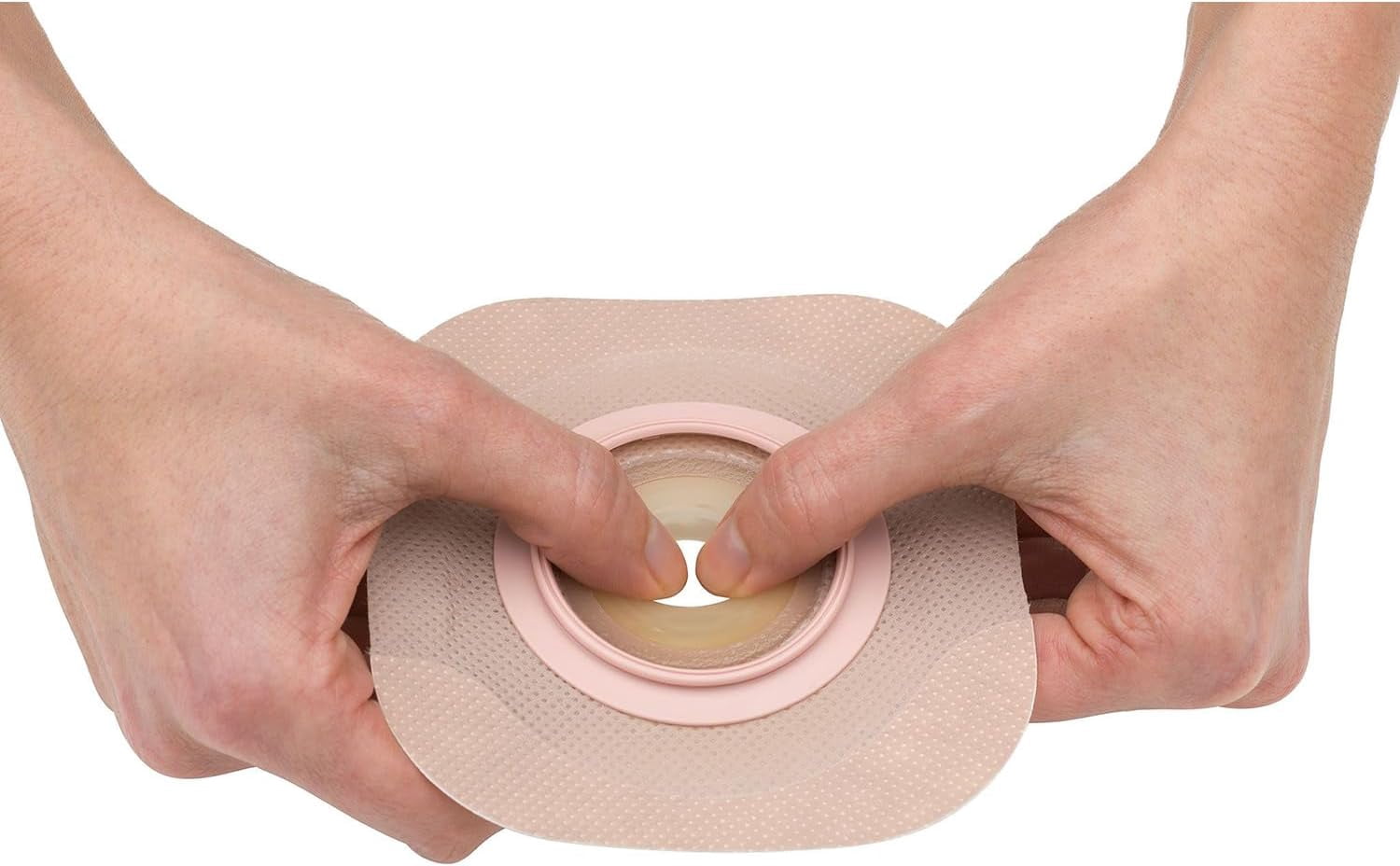New Image FormaFlex Moldable, Extended Wear Ostomy Barrier Adhesive Tape 70 mm Flange 5 per Box 14104