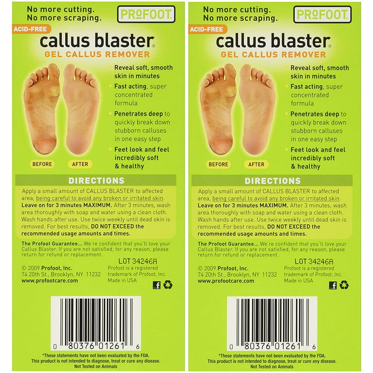 The Best Ways to Get Rid of Calluses, Fluster Buster