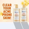 thumbnail image 6 of Biore Witch Hazel Face Wash Cleanser, Acne Prone Skin Care, 6.77 fl oz, 6 of 9