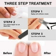 thumbnail image 2 of Professional Cuticle Trimmer Nail Cuticle Cutter Stainless Steel Cuticle Nippers with Sharp Blades of Cuticle Remover Clippers Manicure Tools Double Spring - Pedicure Nail Tools (Black - 4 Pack), 2 of 7