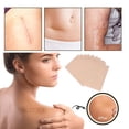 thumbnail image 3 of Sonew 100PCS  Cover Up Patches, Low Sensitivity Birthmark  Sticker Invisible Flaw Conceal Sticker Scar Cover Up Tape for Arms Shoulders Legs, 3 of 7