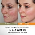 thumbnail image 3 of Toallitas Limpieza Facial Rvlaim con Cúrcuma y Ácido Kójico 50 PCS, 3 of 7