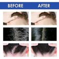 thumbnail image 5 of 1-3Pcs Seborrheic Dematits Cream, Psoriasis Cream, Dry ScalpTreatment, Anti-Itch Cream, Folliculitis Treatment, Soothing Relief, Upgraded Formula 50g, 5 of 5