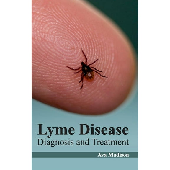 Lyme Disease: Diagnosis and Treatment, (Hardcover)