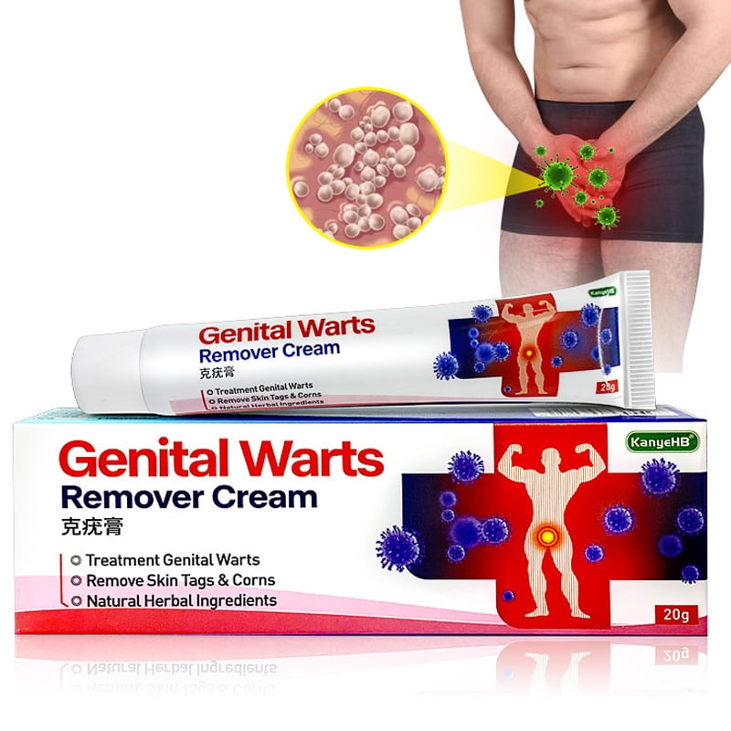 genital warts treatment