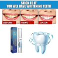 thumbnail image 5 of New- Teeth Cleaning Pen Oral Cleaning Plaque Cleaner White Teeth Beautifying Pen, 5 of 5