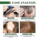 thumbnail image 4 of Batana Oil for Hair Growth, 100% Pure Batana Oil Natural Hair Growth Treatment Oil cares for hair thickness and scalp and, 4 of 5