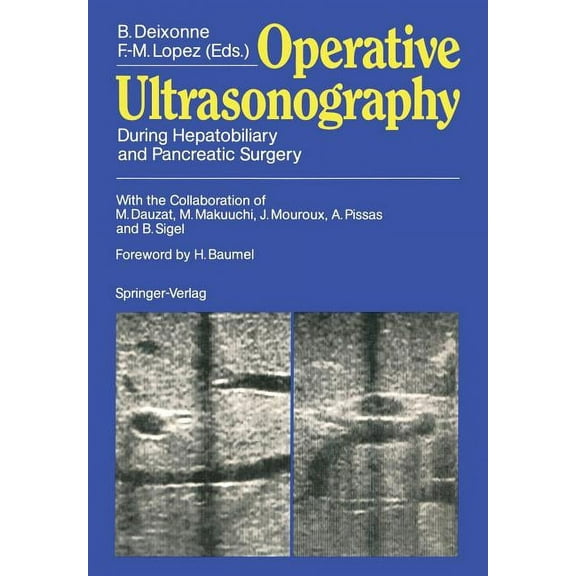 Operative Ultrasonography: During Hepatobiliary and Pancreatic Surgery, (Paperback)