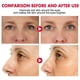 thumbnail image 5 of Fiudx Barra de Ojos con Retinol, Crema Hidratante Antiedad para Ojos, Tratamiento Antibolsas y Ojeras, Solución Hidratante Reafirmante, Rutina Diaria de Cuidado de La Piel, Apta para Todo Tipo de Pie, 5 of 6