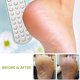 thumbnail image 4 of Lima para pies, removedor de vello de pies de doble cara, exfoliante para tratamiento de pies de acero inoxidable, 4 of 6