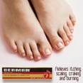 thumbnail image 5 of Derman Antifungal Cream for The Treatment of Athlete's Foot, 1.76 oz, 5 of 8