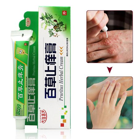 25g Anti-itch Cream Relieves Itching Skin Pruritus Dermatitis Treatment Ointment For Hand Foot Leg