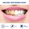 thumbnail image 5 of Jaysuing De Los Dientes Pluma De Limpieza De Dientes Para Eliminar La Suciedad De Los Dientes Amarillos Blanqueamiento De Dientes Pluma De Limpieza Oral |, 5 of 5