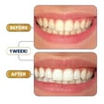 thumbnail image 4 of Lumineux Teeth Whitening 42 Strips 21 Treatments – Peroxide Free - Enamel Safe for Whiter Teeth - Whitening Without The Sensitivity - Dentist Formulated - Sensitivity, 4 of 5