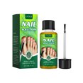 thumbnail image 1 of OUHOE Nail Care Solution, Gentle Repair, Clean, Nourish, Shine And Relieve Uncomfortable Nail Care Solution, 1 of 5