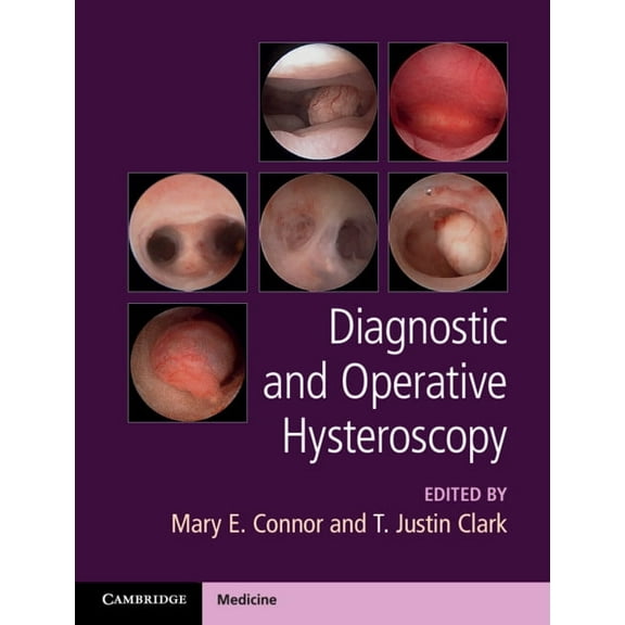 Diagnostic and Operative Hysteroscopy, (Hardcover)