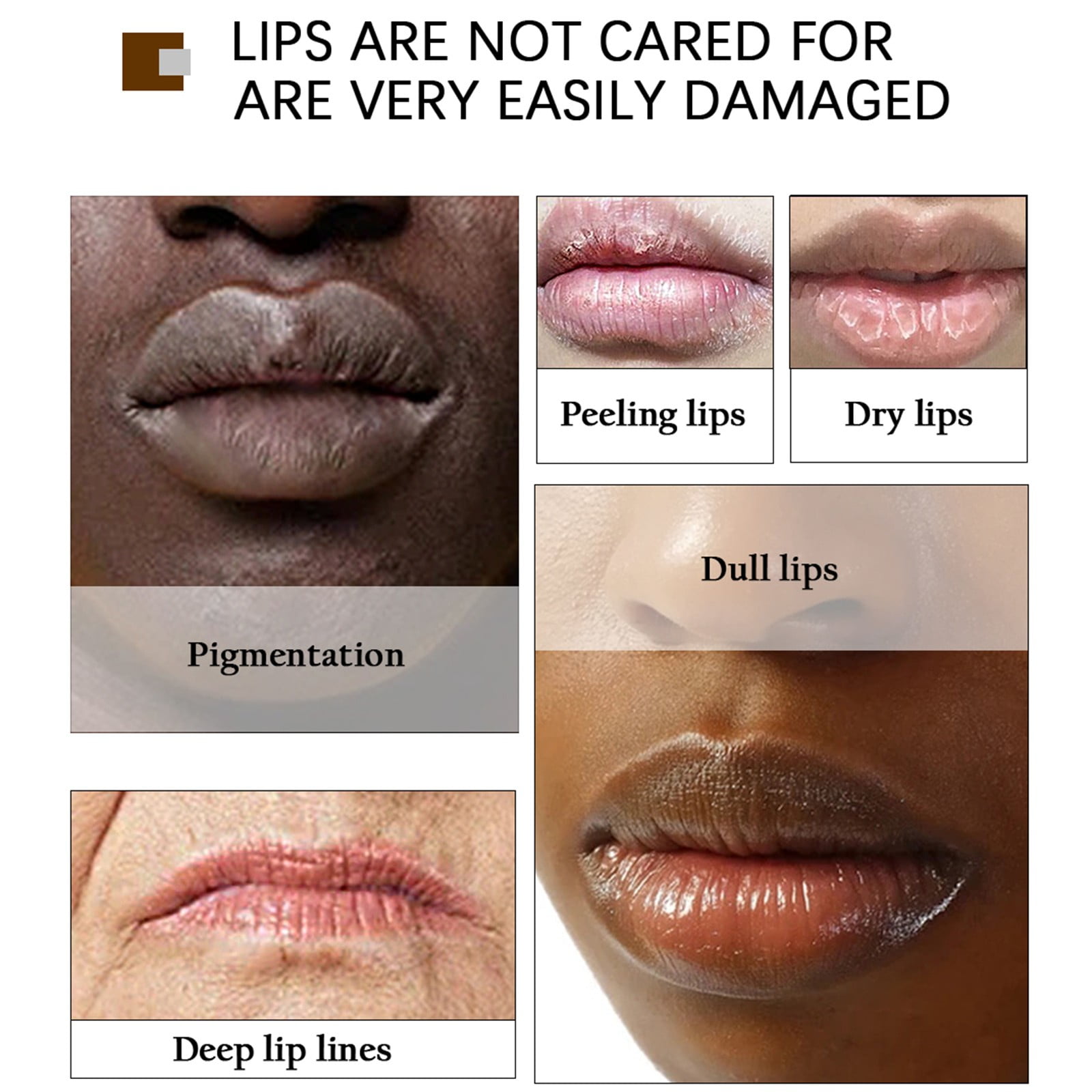 Wholesale Items for Resale Beauty Treatment Pink Fresh Balm Fast Lips Dark  Lips Cream Bleaching Lip Butters Lip Gloss Kit for Girls 10-12 (black, One