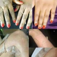 thumbnail image 5 of Suero blanqueador amarillo, aceite Exfoliante para el cuidado de la piel muerta, elimina la piel oscura, brazos, rodillas, piernas, melanina, exfoliante corporal brillante, 5 of 5