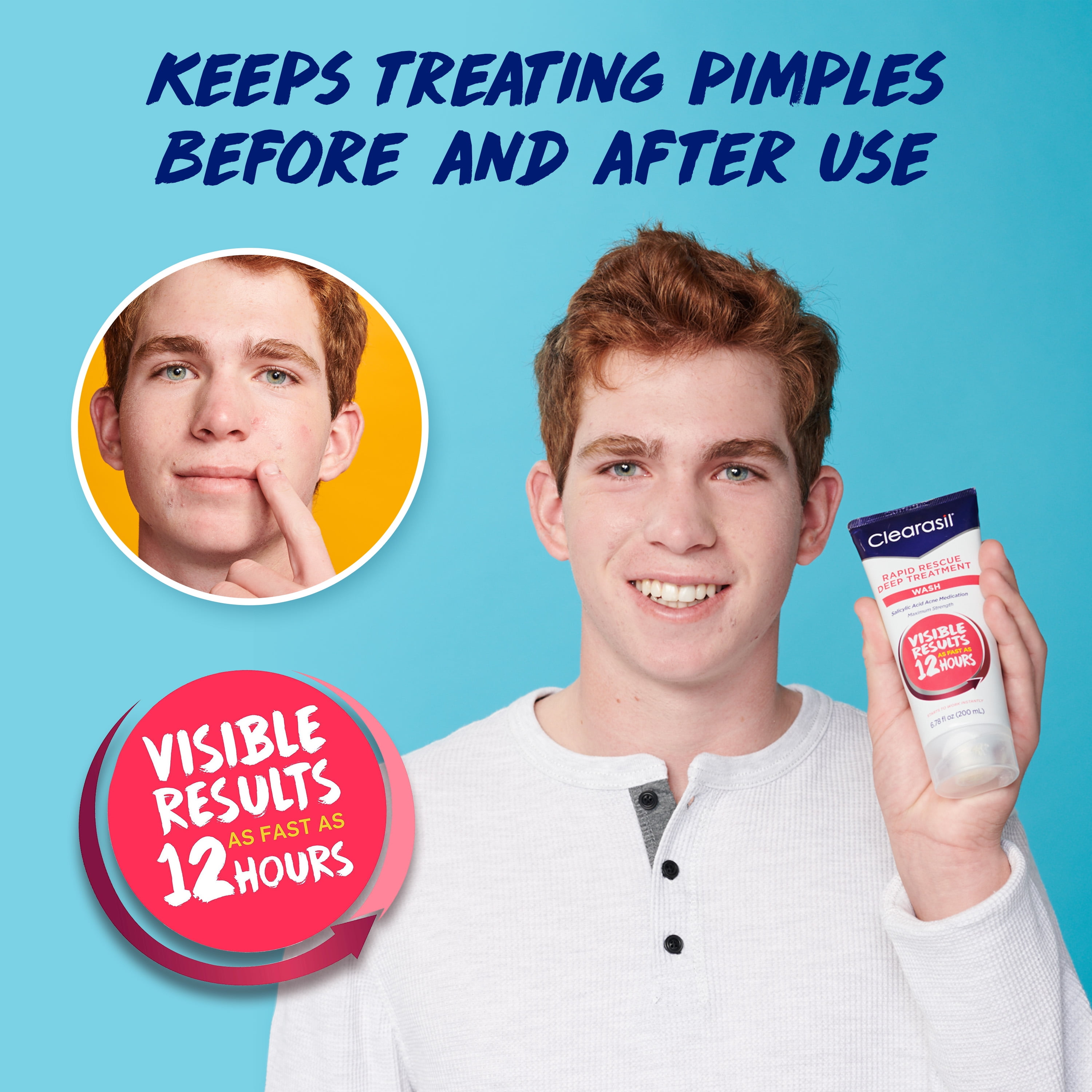 clearasil deep treatment wash