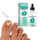thumbnail image 2 of Aceite Para Hongos En Las Uñas De Los Pies, Líquido Fácil De Aplicar Para Eliminar Hongos En Las Uñas, Suave Para El Cuidado De Las Uñas, 2 of 8