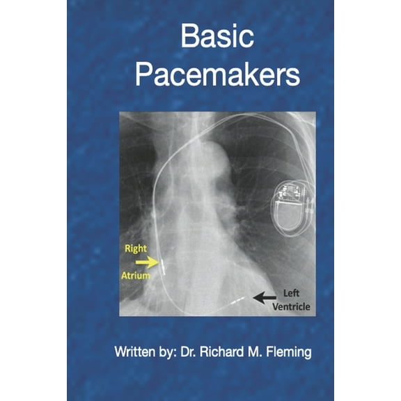 Basic Pacemakers (Paperback) by Richard M Fleming