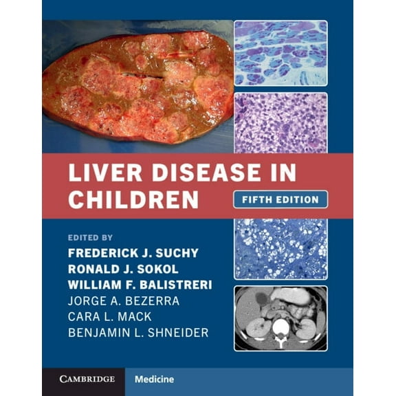 Liver Disease in Children, (Hardcover)