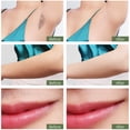 thumbnail image 5 of Depilación láser permanente para mujeres, depiladora casera, axila, pierna, brazo, línea de bikini, depiladora indolora MFZFUKR CPB-DE-LYY233-2, 5 of 5