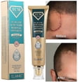 thumbnail image 2 of Crema para eliminar cicatrices quirúrgicas quemadas, Gel que se desvanece, reparación del acné, marcas de viruela, estrías, cicatriz de cesárea brillante, cuidado de la piel suave, 30g, 2 of 5