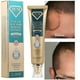 thumbnail image 2 of Crema para eliminar cicatrices quirúrgicas quemadas, Gel que se desvanece, reparación del acné, marcas de viruela, estrías, cicatriz de cesárea brillante, cuidado de la piel suave, 30g, 2 of 5