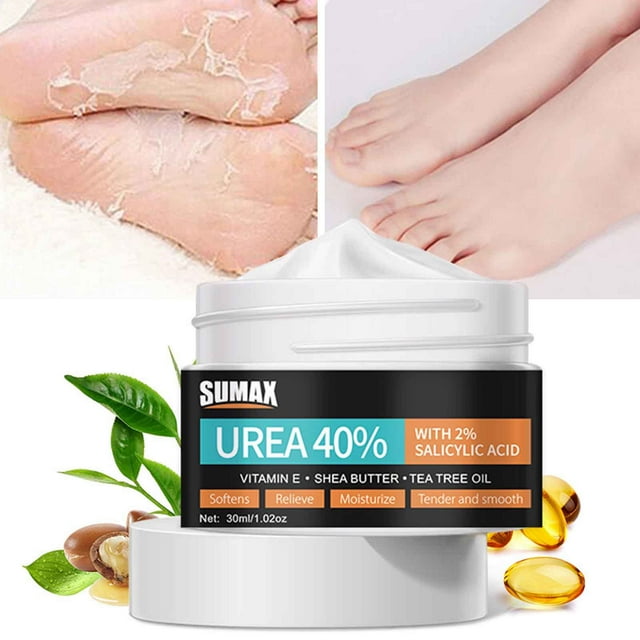 XWSHYW Productos de Salud Crema de Urea 40% | 2% de Ácido Salicílico | Crema Intensiva de Urea para Pies y Removedor de Callos con Aloevera y Aceite de Árbol de Té para Hidratar y Suavizar La Piel 30
