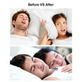 thumbnail image 2 of Graflsoa Invisible Nasal Dilators for Snoring Relief, 3-Pack S Size, Transparent & Comfortable Nighttime Nose Support for Better Breathing and Sleep, 2 of 7