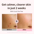 thumbnail image 2 of Crema hidratante para la piel Aplin Pink Tea Tree 50 g, 2 of 8