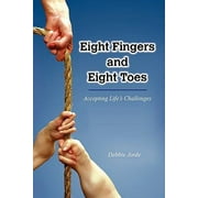 Eight Fingers and Eight Toes : Accepting Life's Challenges, Used [Paperback]