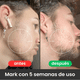 thumbnail image 4 of Bálsamo para Barba Crecimiento - Ultra Potente con Ingredientes Naturales, Hidrata y Engrosa, 2 oz | Organizadores de Maquillaje, 4 of 5