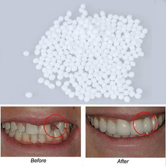 Dental Cement