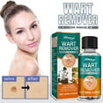 Wart Remover Set Rapidly Plantar And Common Warts Papillomas Skin Tags