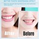 thumbnail image 3 of Cold Serum Teeth Whitening Pen, Cold Serum Teeth Brightening Gel, Fast Whitening Gel for Yellow Teeth & Fresh Breath, 3 of 5