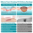 thumbnail image 4 of Dimora 10 Packs Ultra Soft Silicone Foam Dressing 4"x4", Super Absorbent Wound Dressing with Widened Border, Adhesive Foam Bandages for Bed Sores, Ulcer, Surgical Wound, 4 of 10