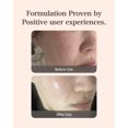 thumbnail image 5 of LOOPS Tónico exfoliante para el cuidado de la piel coreano - Refina la superficie y reequilibra la piel - Cuidado de la piel iluminador y antienvejecimiento - Almohadilla de bambú preempapada - Almoha, 5 of 5