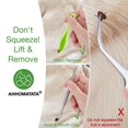thumbnail image 2 of Kit para retirar garrapatas AHHOMATATA, set de acero inoxidable 10 en 1, 2 of 7