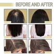 thumbnail image 3 of 1-3X EELHOE Aceite esencial para el crecimiento del cabello con romero Aceite esencial para el cuidado del cabello Cabello grueso, 2 piezas, 3 of 5