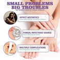 thumbnail image 3 of 2pcs Medinail Nail Fungus Spray Toenail Fungus Treatment, Nail Fungus Treatment For Toenail Gray Nail Repair Spray, 3 of 5