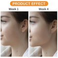 thumbnail image 5 of Jaw Exerciser, Jawline Exerciser, Jaw Exerciser For Women Men, 5 of 5