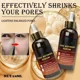 thumbnail image 4 of Suero facial iluminador, renovador y refinador de poros con retinol y niacinamida, no comedogénico, 4 of 5
