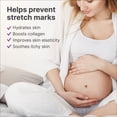 thumbnail image 3 of Crema de prevención de estrías TriLastin Maternity, 120 ml, paquete de 2, 3 of 9