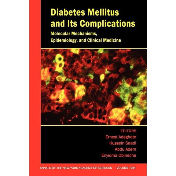 Annals of the New York Academy of Scienc Diabetes Mellitus and Its Complications: Molecular Mechanisms, Epidemiology, and Clinical Medicine, Volume 1084, Book 1084, (Paperback)